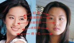 郑州整形失败爆料案件最新,揭秘美容行业潜规则与维权困境